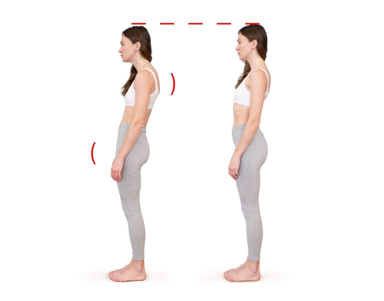 Posture & Gait Correction Program​